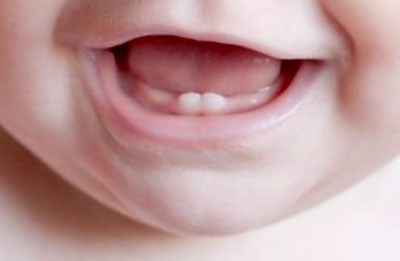 зубки у малыша